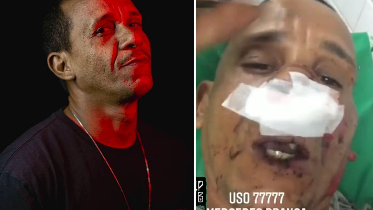 Nego Gallo e esposa sofrem tentativa de homicídio em Fortaleza, rapper precisará passar por cirurgia