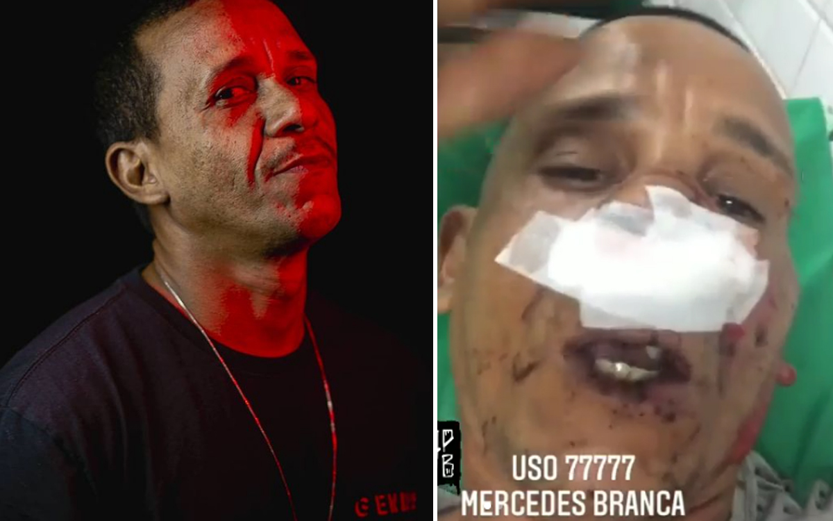 Nego Gallo e esposa sofrem tentativa de homicídio em Fortaleza, rapper precisará passar por cirurgia